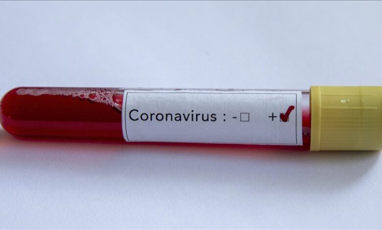 Kosovo: Registrovano 100 novozaraženih koronavirusom
Kosovo: Registrovano 100 novozaraženih koronavirusom Kosovo: Registrovano 100 novozaraženih koronavirusom
Kosovo: Registrovano 100 novozaraženih koronavirusom