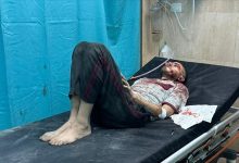 Photo of Oko 650 pacijenata u životnoj opasnosti zbog katastrofalne situacije u bolnici Al-Shifa u Gazi